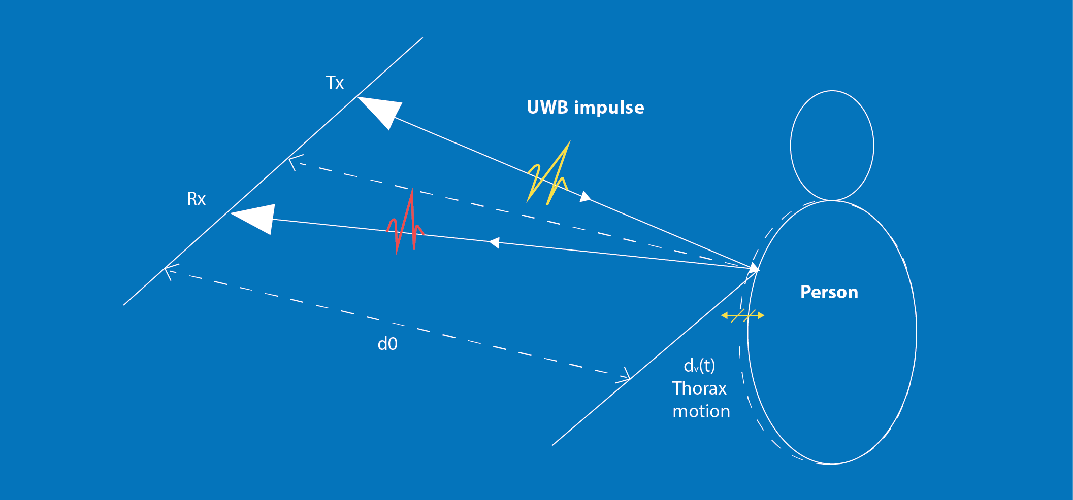 UWB radar Sensor