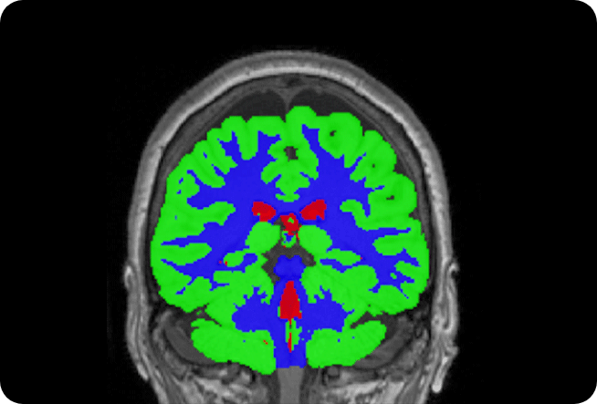 Medical AI segmentation of MRi and CT